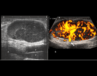 /Content/ServiceImages/Doppler – S Joint.png